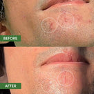 Oil Control Dual Action Blemish Patches Thumb 1