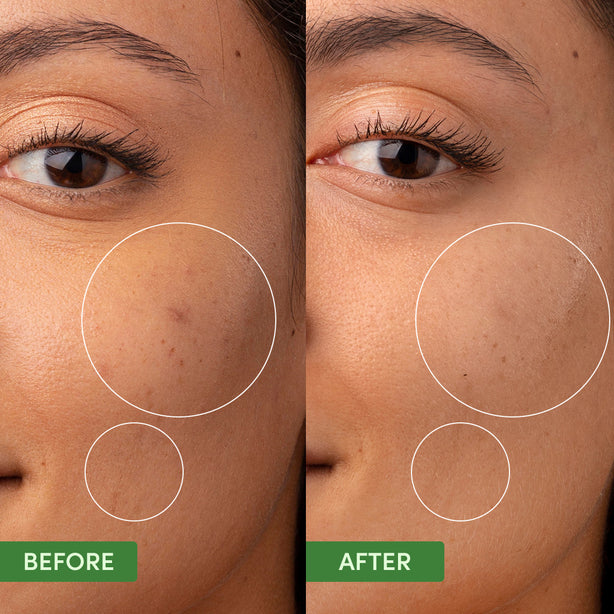 Oil Control Clearing Moisturiser