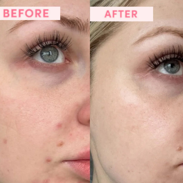 Australian Pink Clay Resurfacing Mask