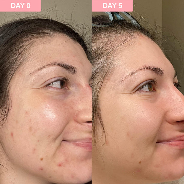 Pro Youth Dark Spot Serum