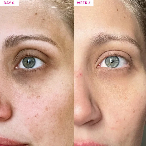 Anti-aging Eye Cream